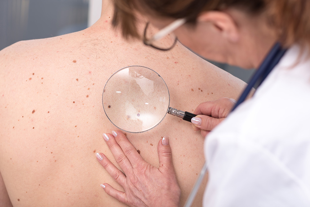 Dermatologist examining the skin of a patient - Swan Dermatology | Dermatology About Flexile Classic